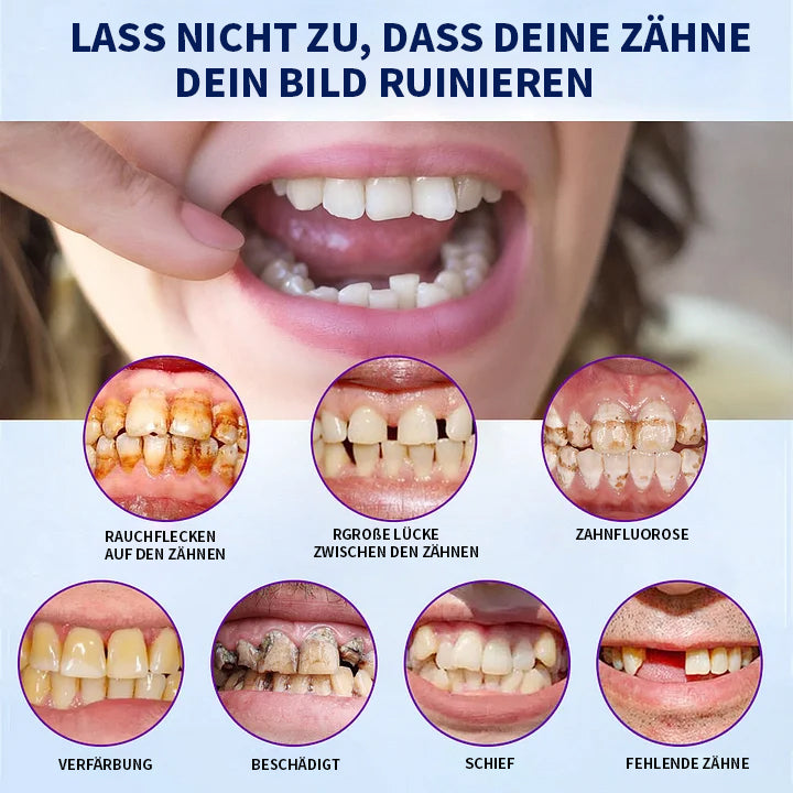 NESLEMY™-🦷 Fortgeschrittenes, maßgeschneidertes Vollprothesen-Set 🦷 (⏰ Limitierter Rabatt, nur noch 30 Minuten verfügbar ⏰)