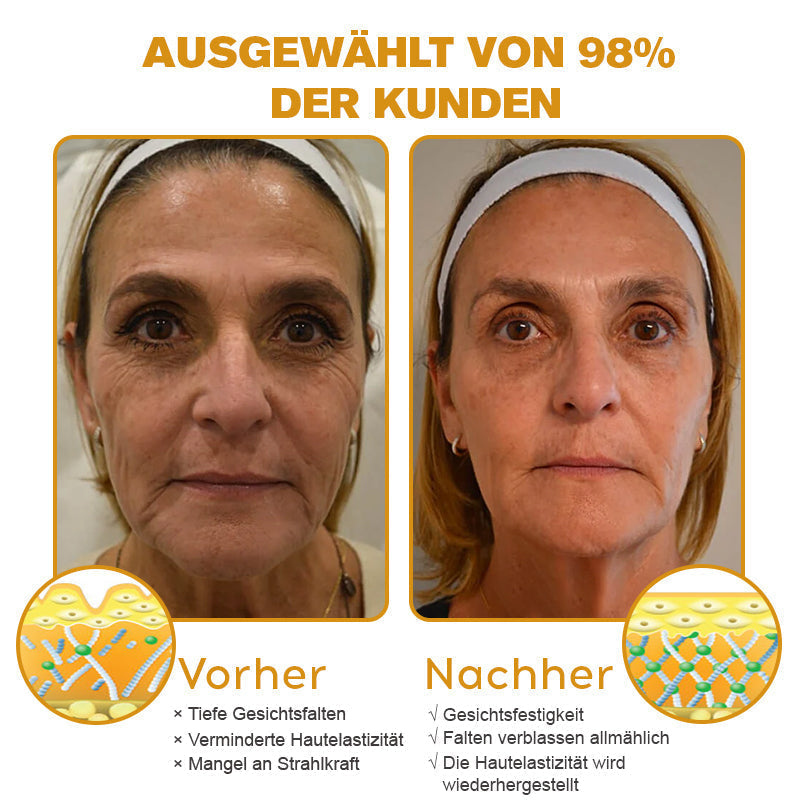 (♥Produziert und versandt aus Deutschland ✅) LOVILDS™ Botulinumtoxin Bienengift Faltenentfernung Creme - LETZTER TAG 70% RABATT