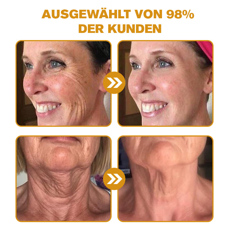 (♥Produziert und versandt aus Deutschland ✅) LOVILDS™ Botulinumtoxin Bienengift Faltenentfernung Creme - LETZTER TAG 70% RABATT