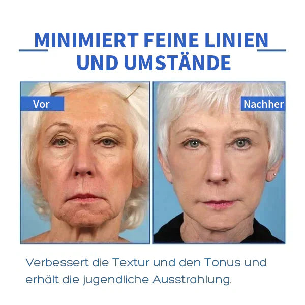 Aktion am letzten Tag: 70% RABATT â đ„ Clostridium botulinum-Gesichtsserum