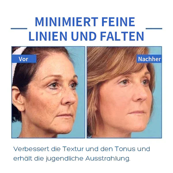 Aktion am letzten Tag: 70% RABATT â đ„ Clostridium botulinum-Gesichtsserum