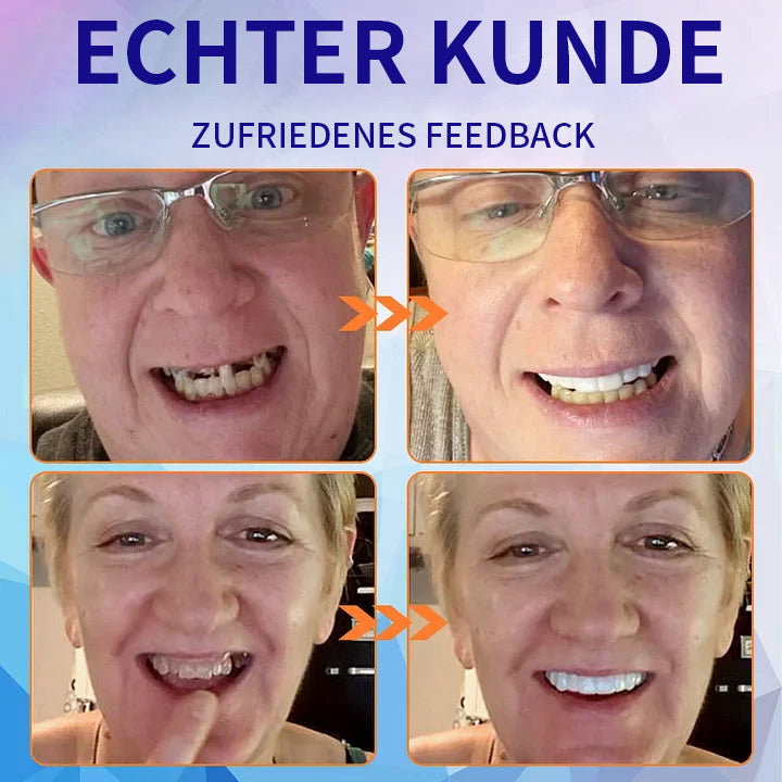 SmileFitPro™- Neue Generation Flexible Vollprothesen-Lösung