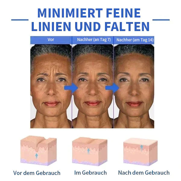 Aktion am letzten Tag: 70% RABATT â đ„ Clostridium botulinum-Gesichtsserum