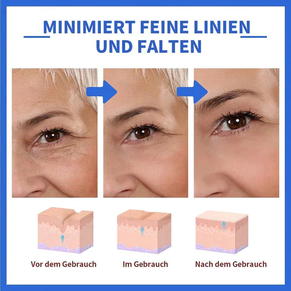Aktion am letzten Tag: 70% RABATT â đ„ Clostridium botulinum-Gesichtsserum