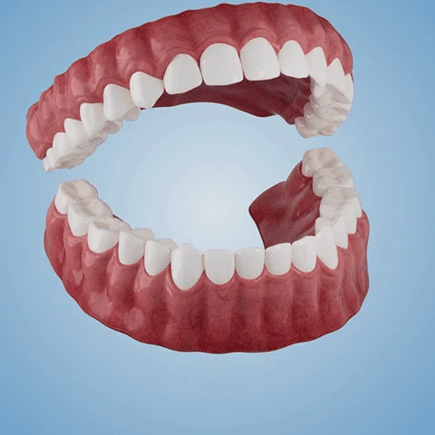 NESLEMY™-🦷 Fortgeschrittenes, maßgeschneidertes Vollprothesen-Set 🦷 (⏰ Limitierter Rabatt, nur noch 30 Minuten verfügbar ⏰)
