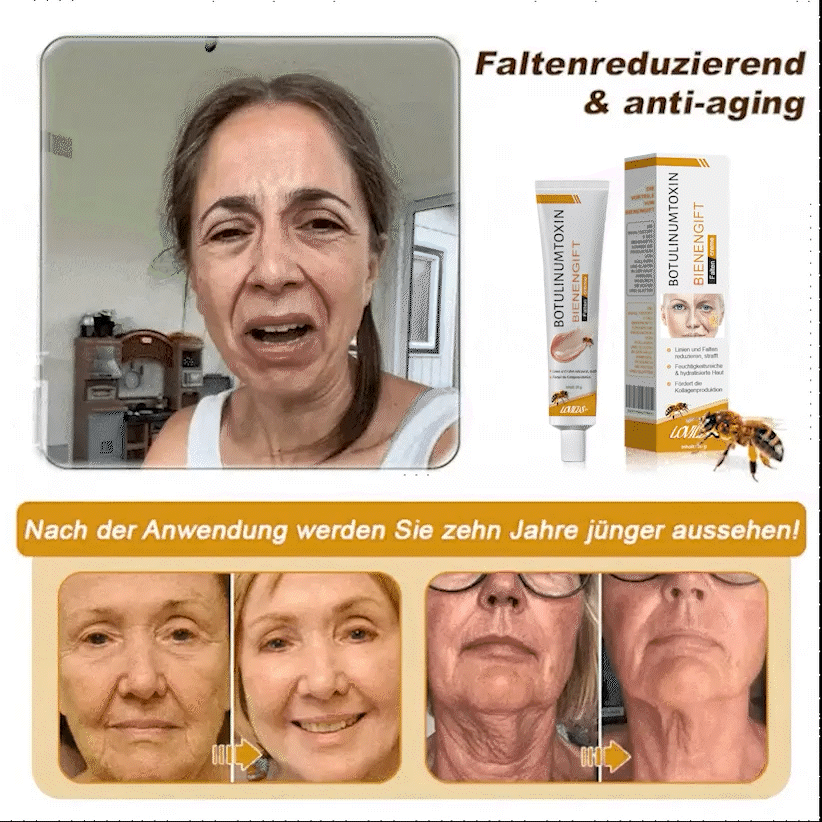 (♥Produziert und versandt aus Deutschland ✅) LOVILDS™ Botulinumtoxin Bienengift Faltenentfernung Creme - LETZTER TAG 70% RABATT