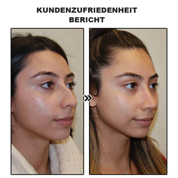 đ„Lymphdrainage-Schlankheitsohrringe (zeitlich begrenzter Rabatt đ„ Letzter Tag)