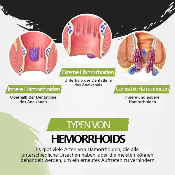 (đ„LETZTER TAG - 60% RABATT AKTION) LOVILDSâą Nr. 1 HĂ€morrhoiden-Behandlungsspray 2024
