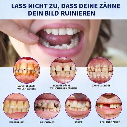 SmileFitPro™- Neue Generation Flexible Vollprothesen-Lösung
