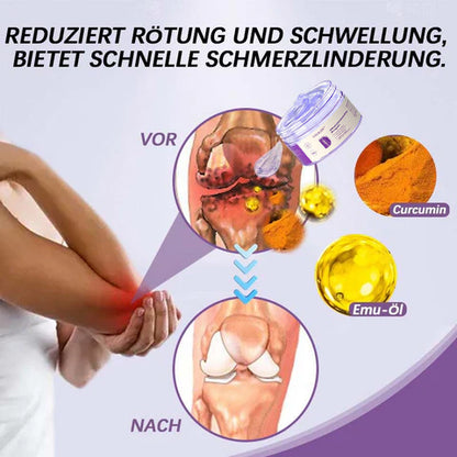 ❤️ Gelenkschmerz-Behandlungsgel – Kurkuma-Extrakt, Emu-Öl, Chondroitin & natürliche Kräuterinhaltsstoffe für Gelenkgesundheit und Schmerzbehandlung – Empfohlen von der DGOU