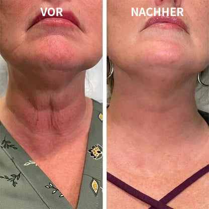 Aktion am letzten Tag: 70% RABATT – 🔥 Clostridium botulinum-Gesichtsserum