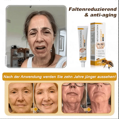 (♥Produziert und versandt aus Deutschland ✅) LOVILDS™ Botulinumtoxin Bienengift Faltenentfernung Creme - LETZTER TAG 70% RABATT