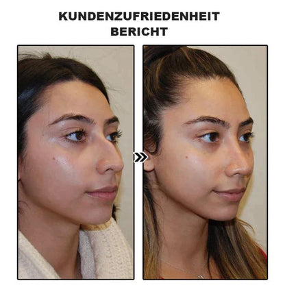 🔥Lymphdrainage-Schlankheitsohrringe (zeitlich begrenzter Rabatt 🔥 Letzter Tag)